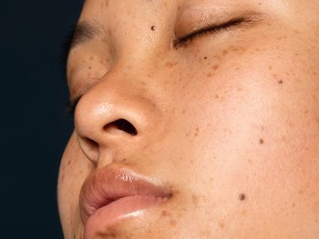 Gesicht einer Frau mit strahlendem Teint und vereinzelnden Pigmentflecken
