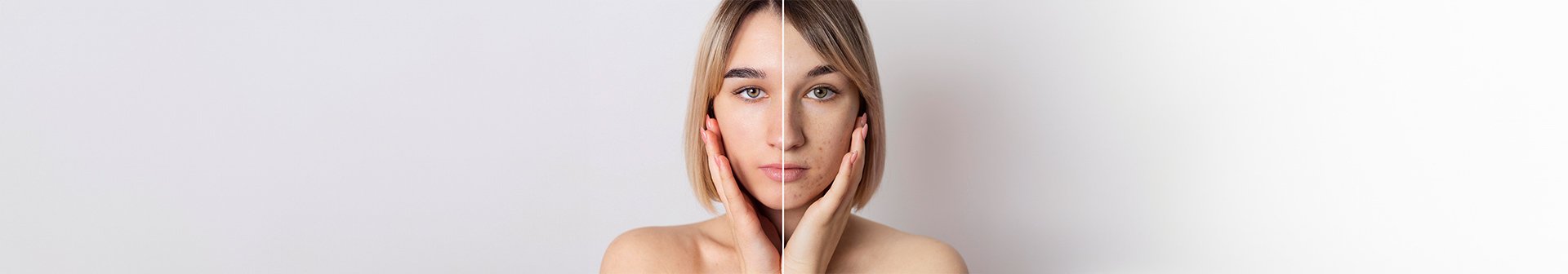 Frau umfässt mit ihren Händen ihr Gesicht