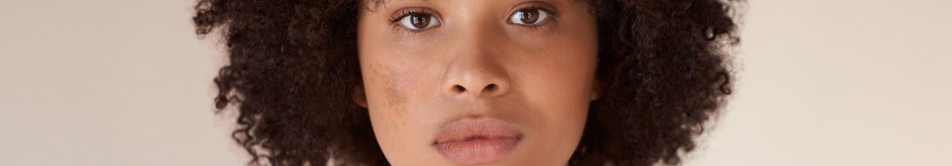 250414 melasma header 1920x336px