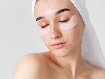 Gesicht einer Frau mit Pickeln und Unreinheiten, die Augenpads trägt