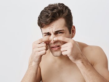 Ein junger Mann drückt einen Pickel auf der Nase aus