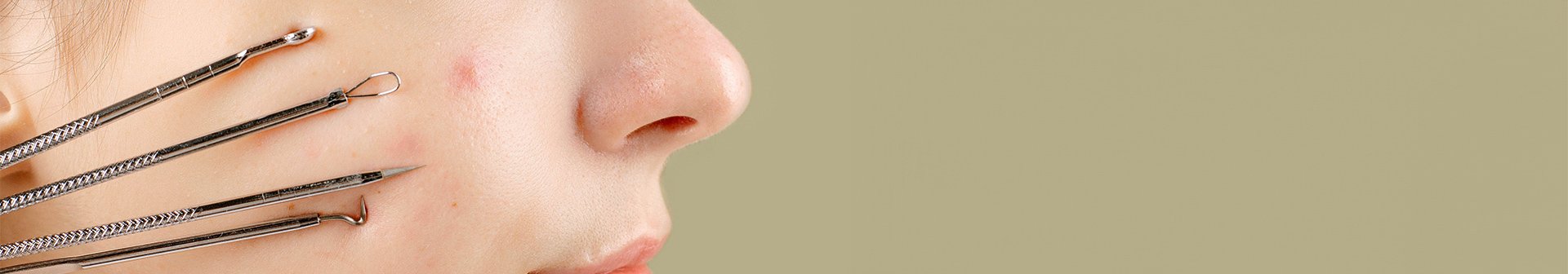 Rechte Gesichtshälfte einer jungen Frau mit Hautunreinheiten und Pickeln sowie einigen medizinischen Werkzeugen