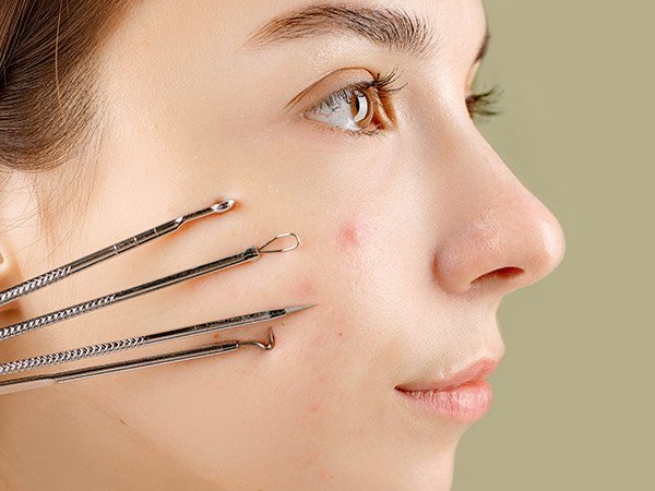 Pickel ausdrücken - ja oder nein? Tipps | Garnier