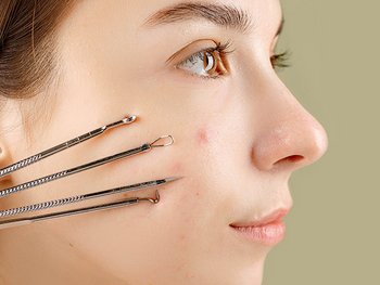 Gesicht einer Frau aus dem Profil mit Komedonenquetscher und anderen Werkzeugen zum Pickel ausdrücke