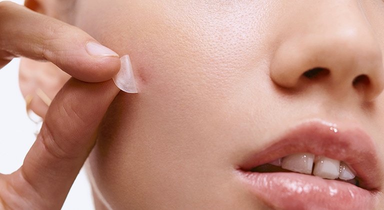 250414 pickel patches data small screen 768x420px