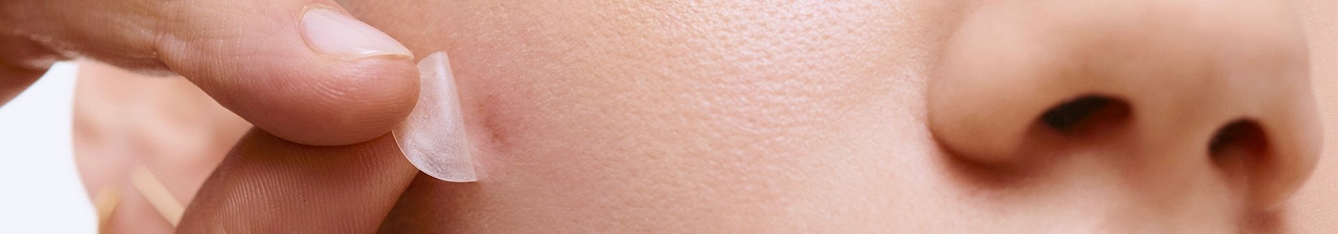 250414 pickel patches header 1920x336px