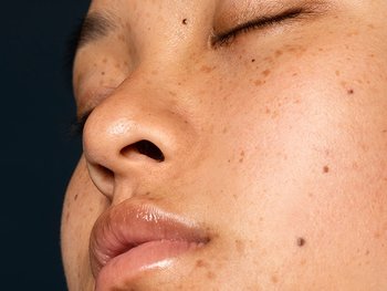 Gesicht einer Frau mit strahlendem Teint