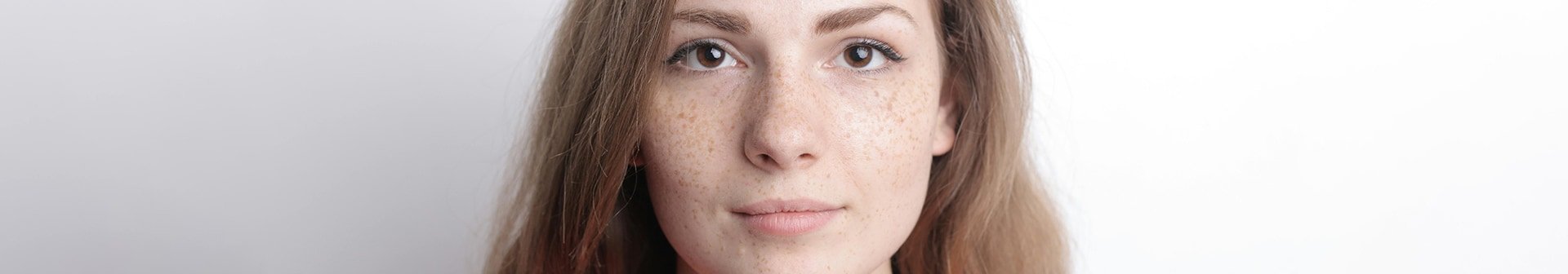 Aufnahme der Gesichtspartie um die Nase mit Pigmentflecken auf den Wangen