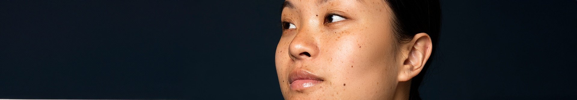 Mund und Nase einer Frau mit Pigmentflecken vor einem schwarzen Hintergrund