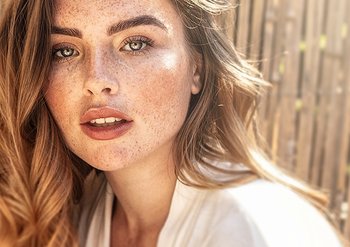 Frau mit Sommersprossen