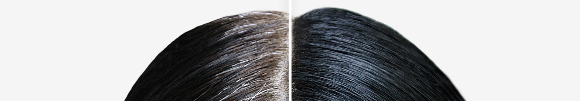 Beispiel für Haaransatz kaschieren