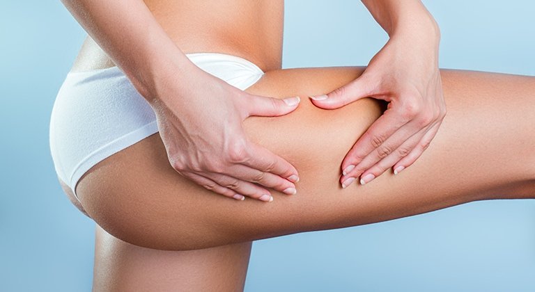 Eine Frau mit weißem Slip fasst sich an den Oberschenkel, um Cellulite zu zeigen