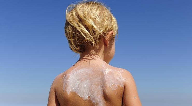 Kind mit Sonnencreme auf dem Rücken