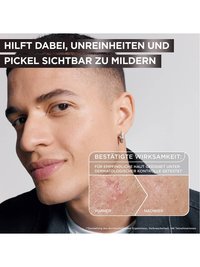 Junger Mann zeigt seine Haut in einem Vorher Nachher Bild