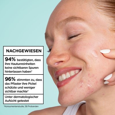 Model zeigt glücklich wie ihre Pickel dank der nachgewiesenen Wirkung der Garnier Pimple Patches Ultra gemildert wurden.