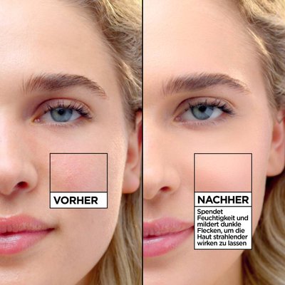 Garnier model von vorne. Sie zeigt dass das Wonder Tint All-In-One Getöntes Fluid ganz einfach und angenehm Flecken abdeckt!