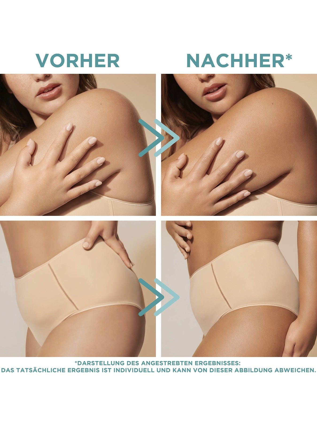 Garnier Natural Bronzer Selbstbräunungs-Mousse Vorher Nachher