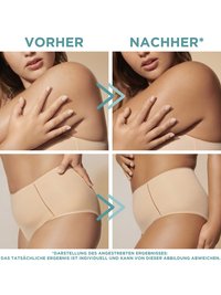 Garnier Natural Bronzer Selbstbräunungs-Mousse Vorher Nachher