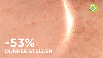 Nahaufnahme von Haut