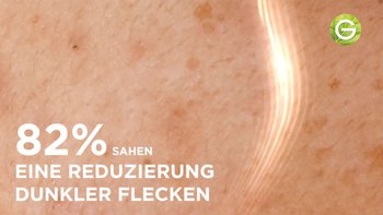 Nahaufnahme von Haut